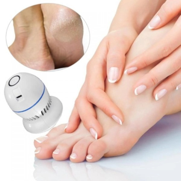 Пемза-пилка электрическая Pedi Vac для ног и пяток с аккумулятором, прибор для удаления мозолей и пилинга