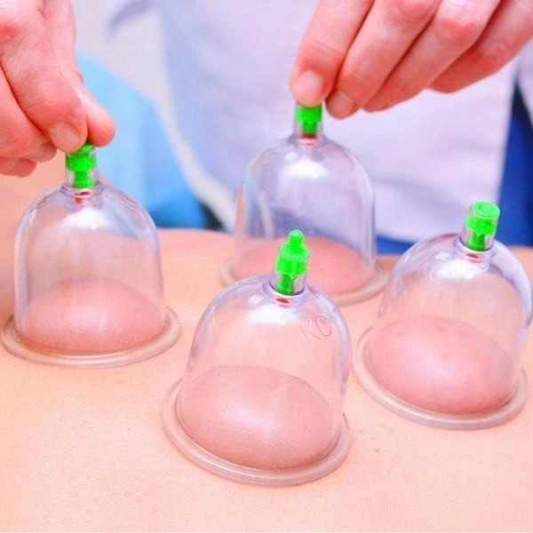 Антицеллюлитные вакуумные массажные банки Pull Out a Vacuum Apparatus 12 шт с насосом для домашнего использова