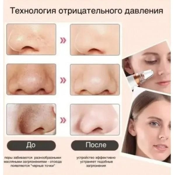 Вакуумный аппарат Multi-Functional для глубокой чистки пор и очистки кожи лица на аккумуляторе
