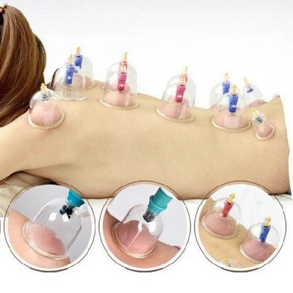 Банки вакуумні для масажу з вакууматором 6 штук вакуумний масажер із насосом