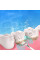 Ультразвуковая зубная щётка-скалер 2в1 Electric Sonic Dental Scaler с зеркалом и 4 сменными насадками