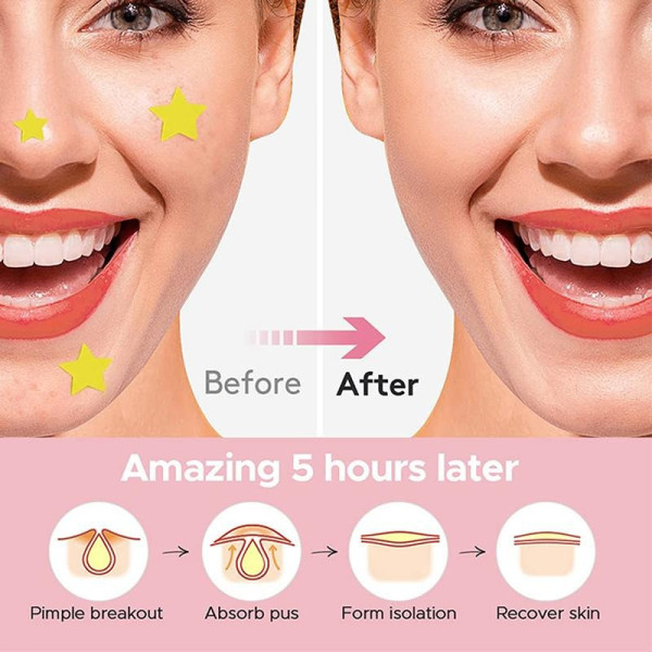 Патчі для обличчя від прищів гідроколоїдні 600 шт. для точкового лікування проблемної шкіри