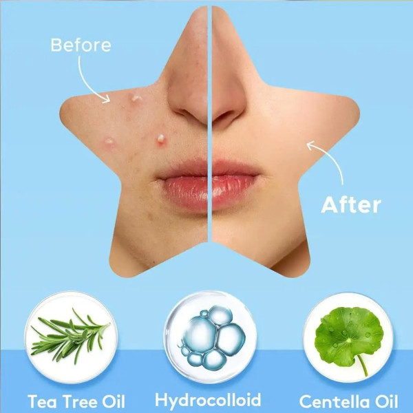 Патчі для обличчя від прищів гідроколоїдні 600 шт. для точкового лікування проблемної шкіри